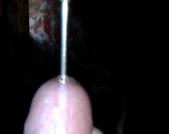 Mumbai boy- metal rod 10-Pounder insertion away from mistress